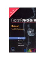 Pocketradiologist Breast:Top 100 Diagnoses