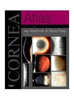 Cornea Atlas,3/e