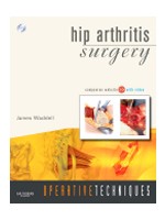 Operative Techniques:Hip Arthritis Surgery