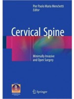 Cervical Spine: Minimally Invasive and Open Surgery