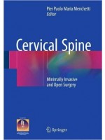 Cervical Spine: Minimally Invasive and Open Surgery