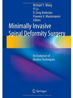 Minimally Invasive Spinal Deformity Surgery