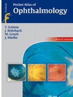 Pocket Atlas of Ophthalmology