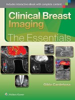 Clinical Breast Imaging: The Essentials