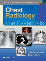 Chest Radiology: The Essentials