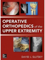 Operative Orthopedics of the Upper Extremity