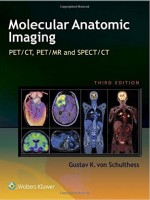 Molecular Anatomic Imaging: PET/CT, PET/MR and SPECT CT