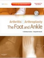 Arthritis and Arthroplasty: The Foot and Ankle - Expert Consult - Online, Print and DVD
