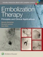 Embolization Therapy: Principles and Clinical Applications