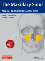 The Maxillary Sinus