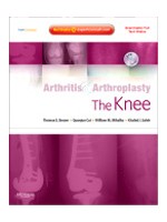 Arthritis & Arthroplasty:The Knee: Expert Consult - Online Print & DVD