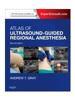 Atlas of Ultrasound-Guided Regional Anesthesia,2/e