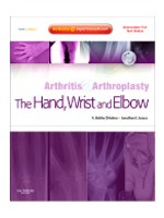 Arthritis & Arthroplasty:The Hand, Wrist & Elbow: Expert Consult-Online, Print & DVD