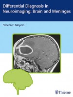 Differential Diagnosis in Neuroimaging Brain and Meninges