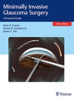 Minimally Invasive Glaucoma Surgery : A Practical Guide