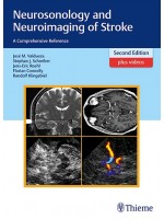 Neurosonology and Neuroimaging of Stroke 2e