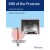 MRI of the Prostate : A Practical Approach