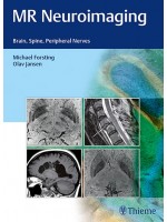 MR Neuroimaging : Brain, Spine, and Peripheral Nerves