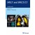 SPECT and SPECT/CT