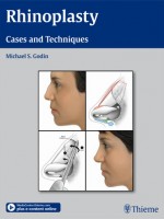 Rhinoplasty : Cases and Techniques