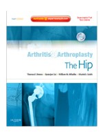 Arthritis & Arthroplasty:The Hip: Expert Consult - Online Print & DVD