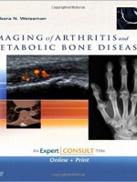 Imaging of Arthritis and Metabolic Bone Disease