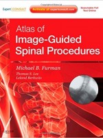 Atlas of Image-Guided Spinal Procedures: Expert Consult - Online and Print, 1e