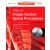 Atlas of Image-Guided Spinal Procedures: Expert Consult - Online and Print, 1e