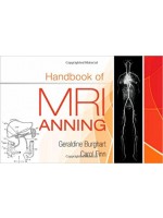 Handbook of MRI Scanning