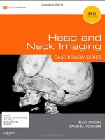 Head & Neck Imaging,3/e: Case Review Series