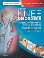 Noyes Knee Disorders (Surgery, Rehabilitation, Clinical Outcomes), 2/e