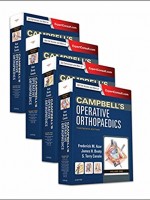 Campbell's Operative Orthopaedics, 4-Volume Set, 13e