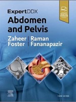 ExpertDDx: Abdomen and Pelvis, 3rd Edition