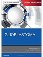 Glioblastoma, 1e