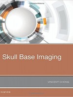 Skull Base Imaging, 1e