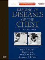 Imaging of Diseases of the Chest,5/e