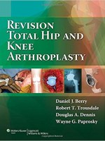 Revision Total Hip & Knee Arthroplasty