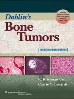 Bone Tumors,7/e
