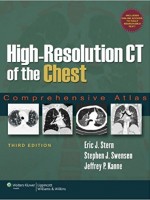 High-Resolution CT of the Chest,3/e: Comprehensive Atlas