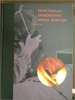 Functional Endoscopic Sinus Surgery: The Messerklinger Technique
