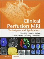 Clinical Perfusion MRI: Techniques and Applications