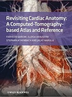 Revisiting Cardiac Anatomy: A Computed-Tomography-Based Atlas and Reference