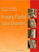 Imaging Painful Spine Disorders