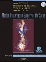 Motion Preservation Surgery of the Spine: Advanced Techniques & Controversies