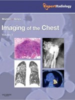 Imaging of the Chest (2Vols): Expert Radiology Series