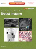 Breast Imaging: Expert Radiology series