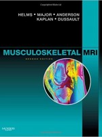 Musculoskeletal MRI,2/e