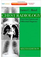 Chest Radiology,6/e: Plain Film Patterns & Differential Diagnoses