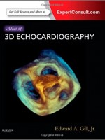 Atlas of 3D Echocardiography