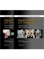 Multi-Detector CT Imaging Handbook(2vols)